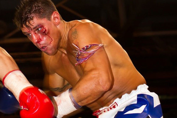 Альберт Краус неважно выглядел в конце боя против Бату